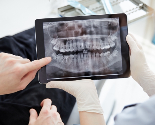 oralchirurgie-2